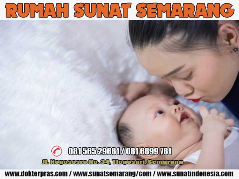 081-6699-761 // TEMPAT SUNAT BAYI MODERN DI GAJAH MUNGKUR – SEMARANG